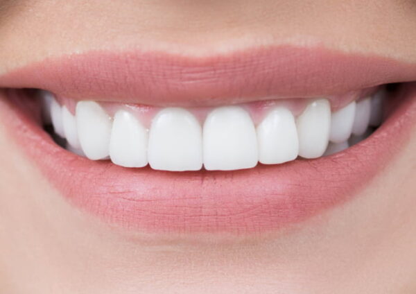 After -Abington Dental
