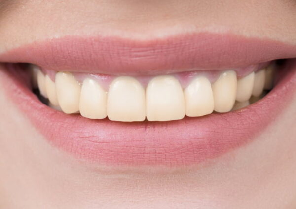 Before - Abington Dental