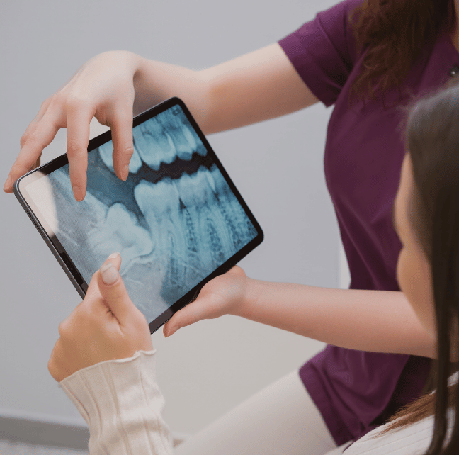 Tooth Extraction