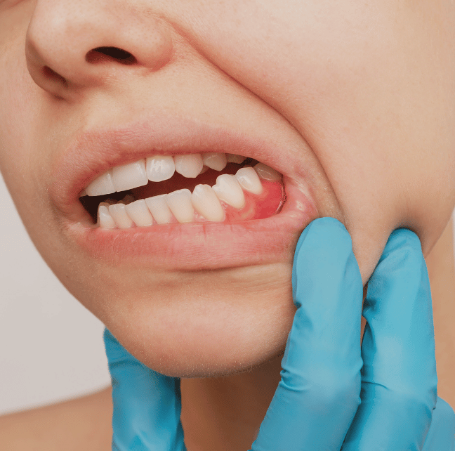 Treatment - Abington Dental Practice